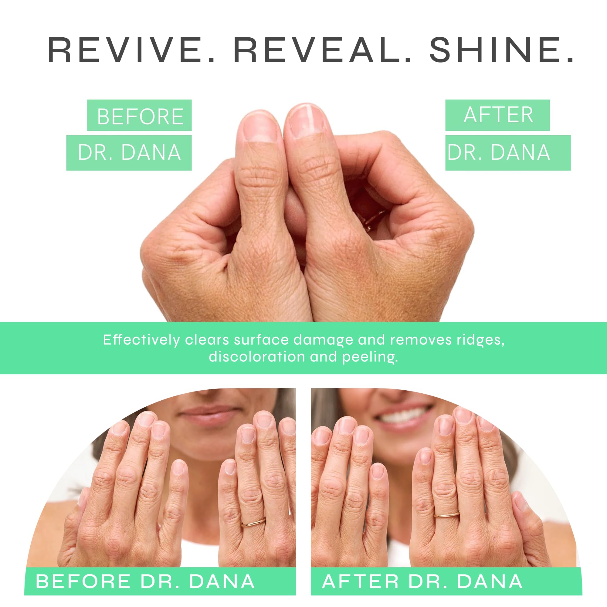 Dr-Dana-Best-Buffing-Block=Before-and-After
