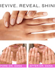 Dr-Dana-How-to-Get-Shiny-Nails-Before-and-After