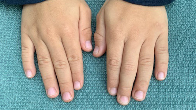Kids and Healthy Nail Care