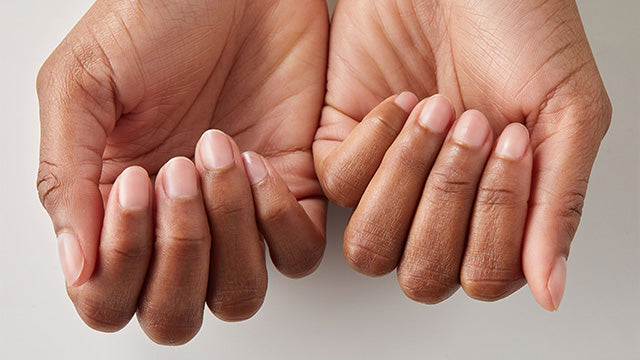 Blog-Dr-Dana-Brittle-Nails-Treatment-and-Causes