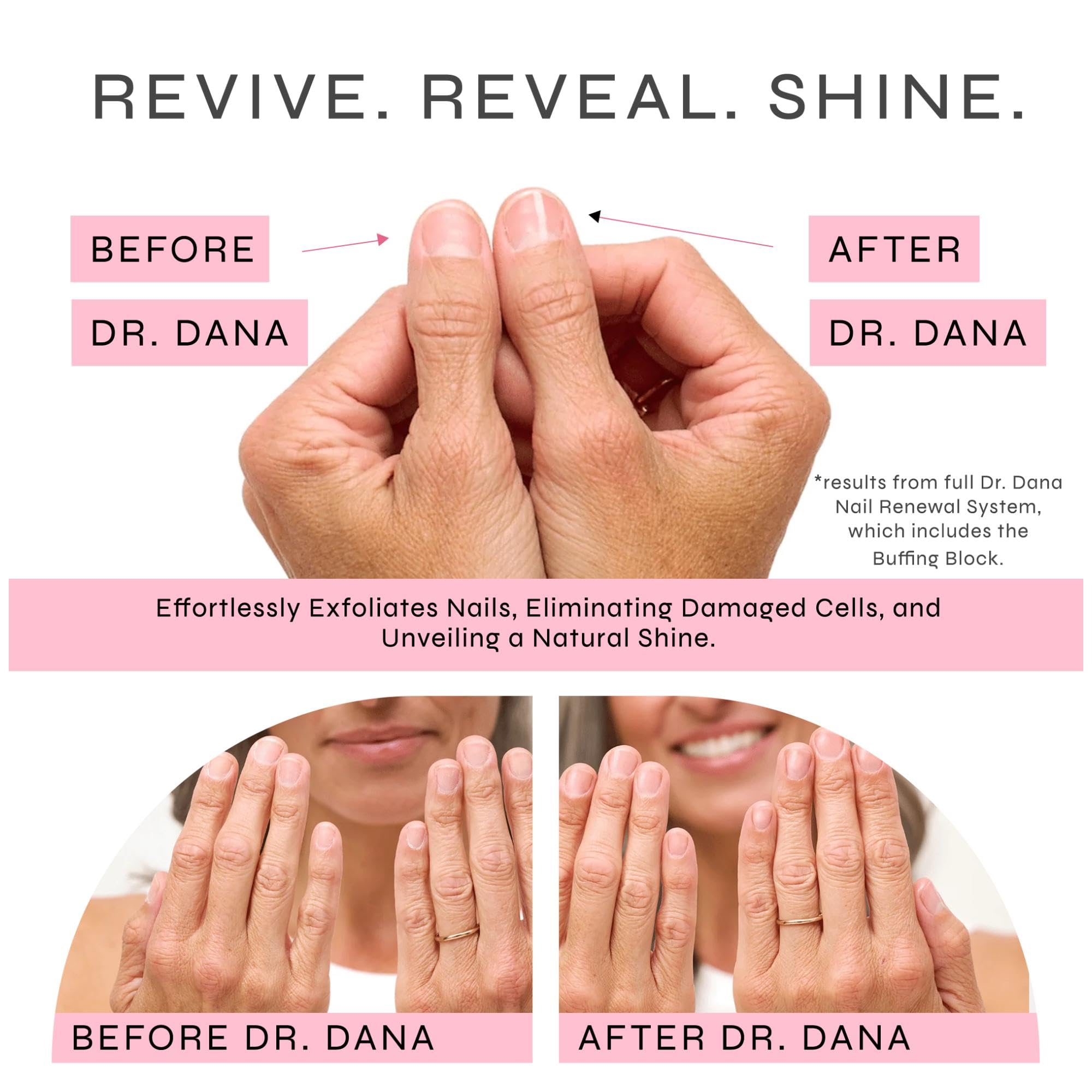 Dr-Dana-Nail-Care-Before-and-After