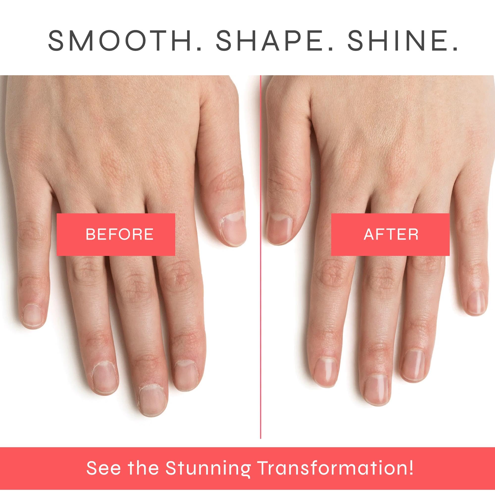 Dr-Dana-Smooth-Shine-Shape-Nails-Before-and-After